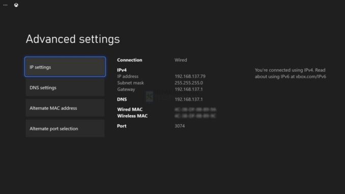 Comment configurer la DMZ sur la Xbox Series S